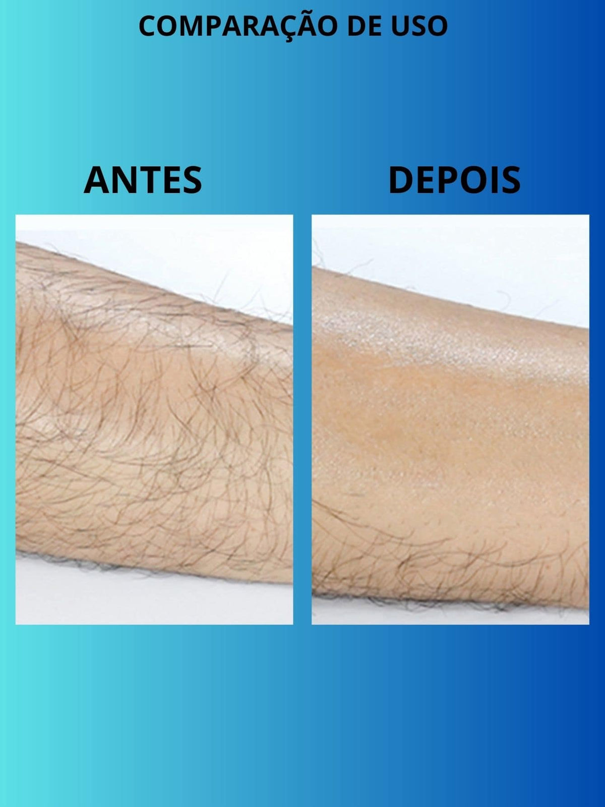 Depilador Cristal Reutilizável Removedor de Pelos Indolor